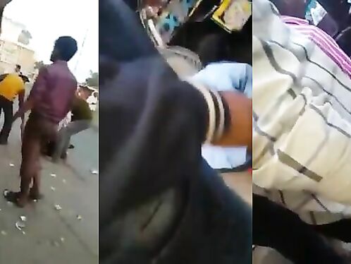 Accident - Internal Organs Coming Out Of The Stomach