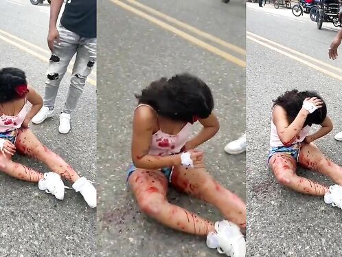 Chicken Shocked, Face Peeled