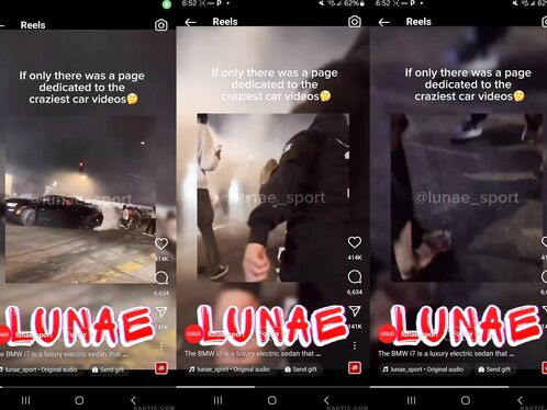 Her Foot Was Crushed By A Drifting Car.