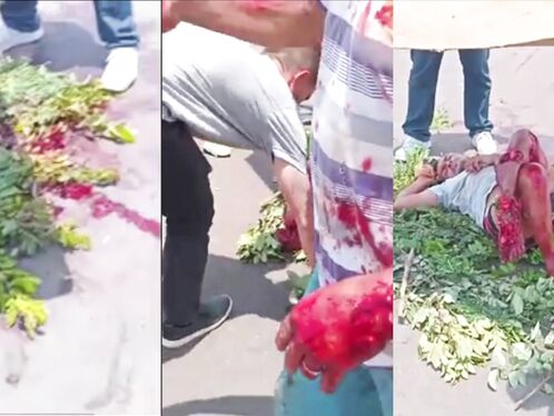 The Legs Were Completely Destroyed