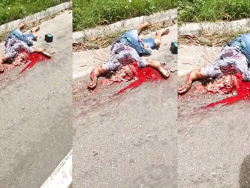 This Guy's Head Was Crushed.