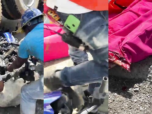 Motorcyclist Suffers Serious Leg Injuries After Crashing Under Truck