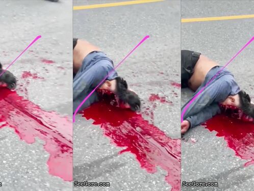 The Face Was Torn And The Brain Was Splattered