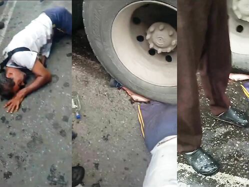 Football Fan's Legs And Dreams Destroyed By Truck