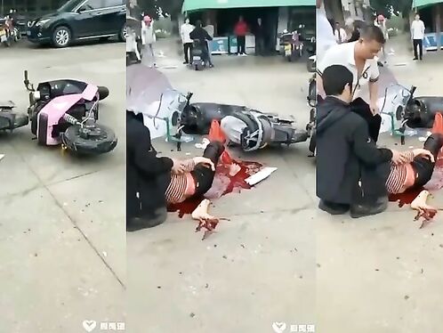 The Woman's Leg Was Broken