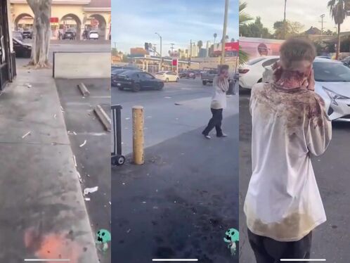 That Guy Was Walking Around Bleeding.