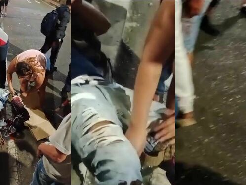 Serious Leg Injuries After Motorcycle Accident