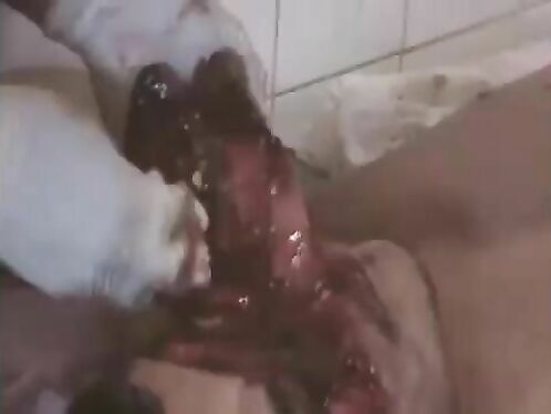 Motorcycle Accident In New Guinea