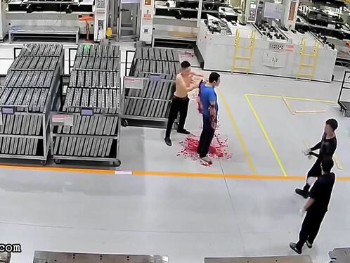 Man Loses Both Arms Due To Work