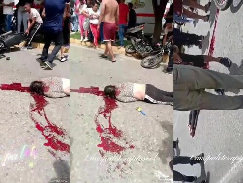 Young Nurse Dies In Collision Between Two Motorcycles