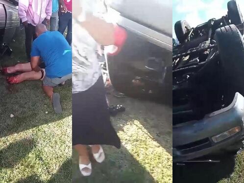 The Woman Was In Shock, Her Legs Were Torn Apart Like Pulled Pork