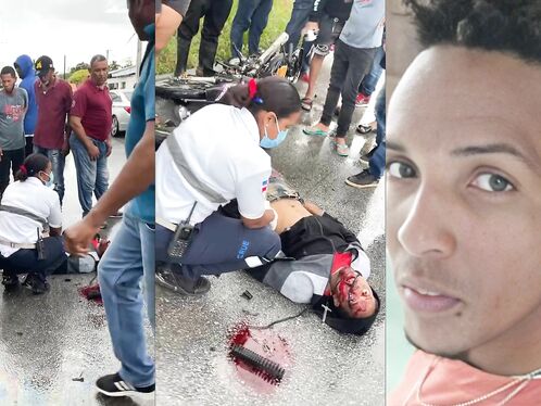 The Cyclist Didn't Notice The Truck And His Eyes Dropped.