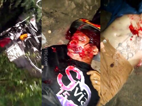 The Aftermath Of A Brutal Bicycle Accident