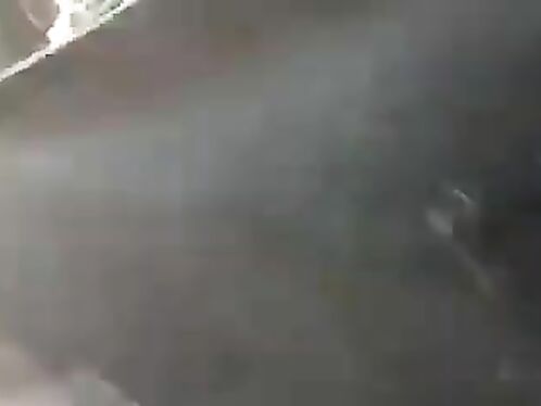 The Accident Caused Many Injuries