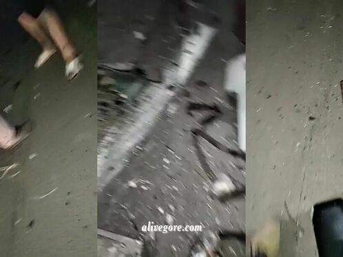 The Result Of A Terrible Bus And Car Accident V