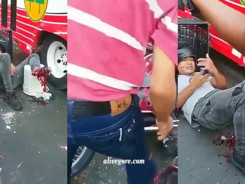 A Motorcyclist Who Suffered A Leg Injury In An Accident Received An S-point