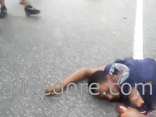 Two People Lost Limbs In A Traffic Accident Uncensored