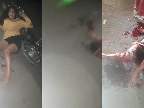 In An Accident, A Woman Broke Her Leg And A Man Lost His Arm