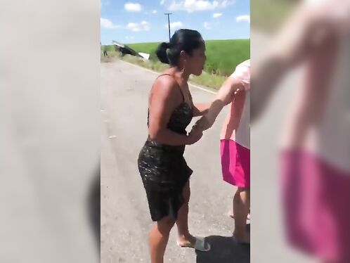 Woman Suffered Scalp Scalp In Accident