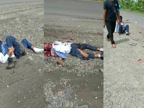 In An Accident, One Was Injured, Another Died, And The Third Also Died.