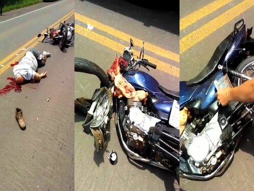 The Man's Head Was Blown Off In The Accident.