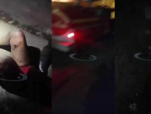 Bomb Explodes At Local Club, Leaving Woman Severely Burned