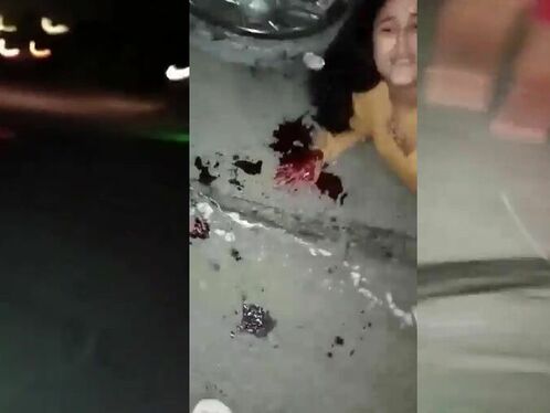 As A Result Of The Accident, The Man Lost A Leg And An Arm.