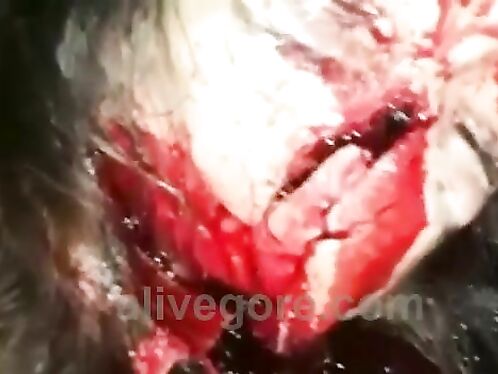 Two Girls Suffer Fractured Skulls, Broken Bones After Car Accident