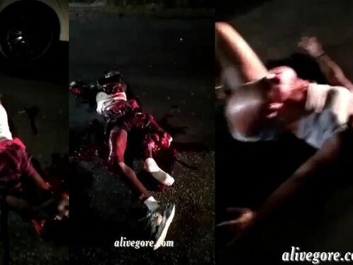 The Result Of A Horrific Accident - A Man's Legs And Arms Were Blown Off