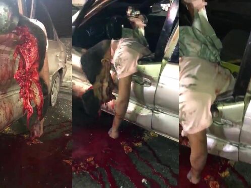 Brutal Head Smashed In Accident And Murder