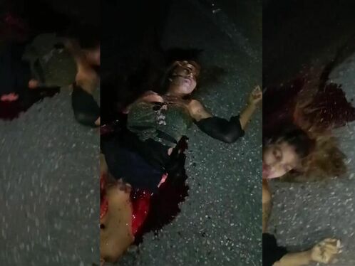 Beautiful Girl Was Accidentally Crushed