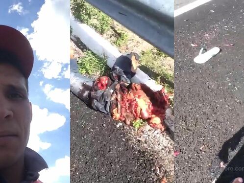 Due To The Accident, Only The Legs Are Left