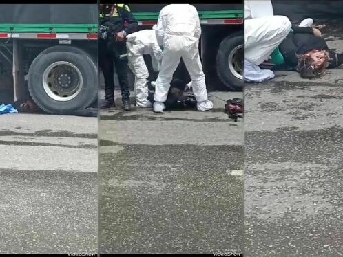 A Woman's Skull Was Crushed In A Horrific Motorcycle Accident.