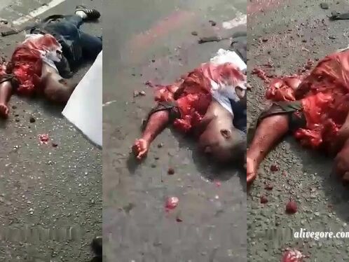 The Heart Of A Person Injured In An Accident Is Still Beating