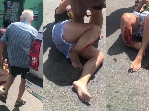 Woman Left With Only One Foot As A Result Of Accident