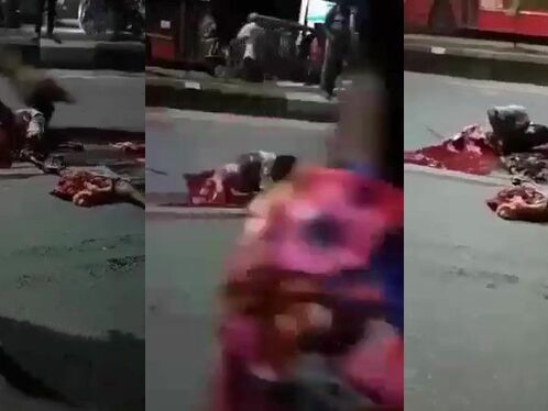 The Man's Lower Body Was Ripped Apart In A Horrific Accident