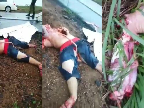 As A Result Of The Accident, The Man's Body Was Completely Mauled.