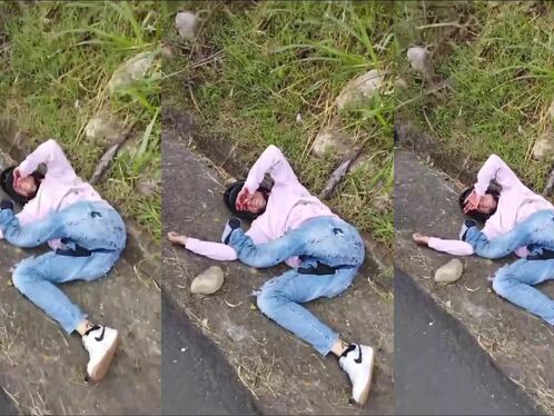 The Poor Victim Of The Accident Received Applause