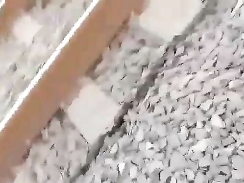 A Passing Train Caused A Man To Lose A Leg