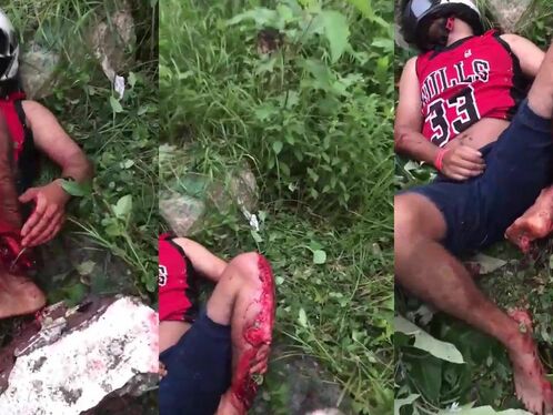 At The Time Of The Accident, The Motorcyclist Kept His Helmet But Not