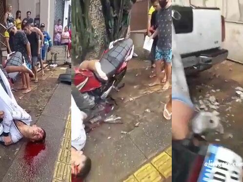 A Man And A Woman Were Riding A Motorcycle When The Accident Happened.