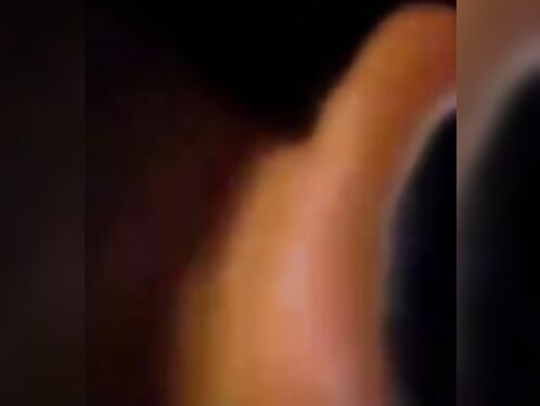 Man's Hand Blown Off By Fireworks