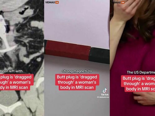 Patient With Metal Sex Toy In Butt Seriously Injured