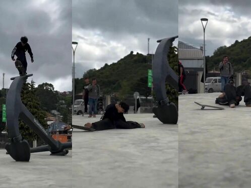 He Needs A New Skateboard.