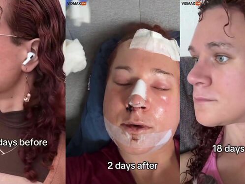 Man wants refund for feminization surgery
