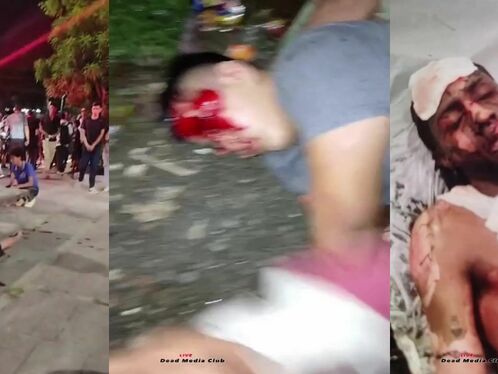 Man suffers severe injuries after gruesome street fight