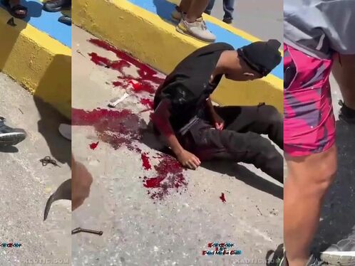 Injured man receiving first aid on the street