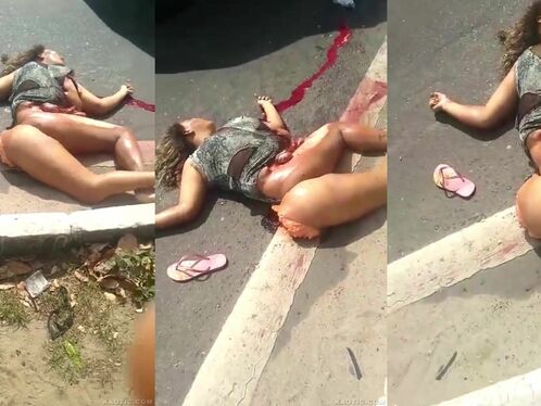 Woman falls into water and gets her foot injured