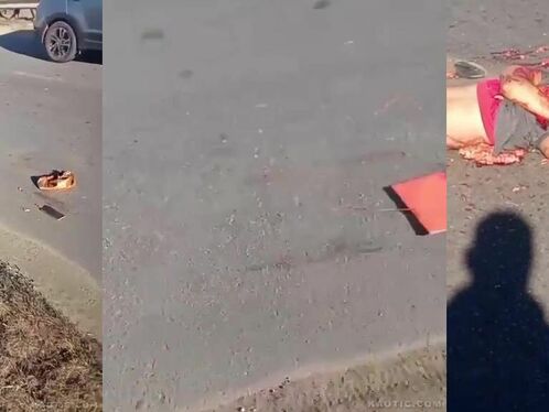 Severely disfigured dead woman lies near the ocean