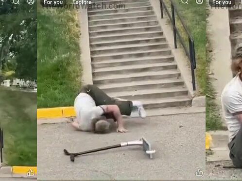 Ankle bends in an unnatural way